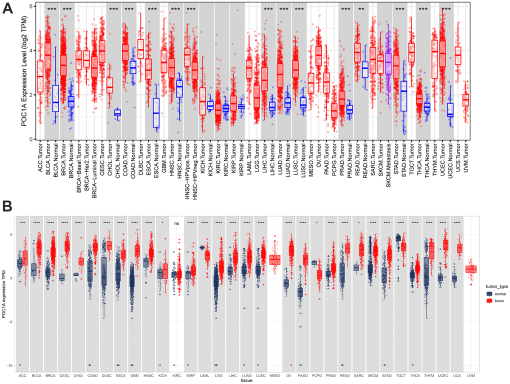 Pan-cancer POC1A expression. (A) POC1A expression analysis in pan-cancer through TIMER2 database utilization. (B) Expression of POC1A in normal and tumor tissues from the GTEx and TCGA cohorts. *P