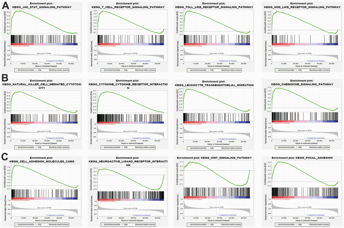 Dna methylation regulated snx20 overexpression correlates with poor