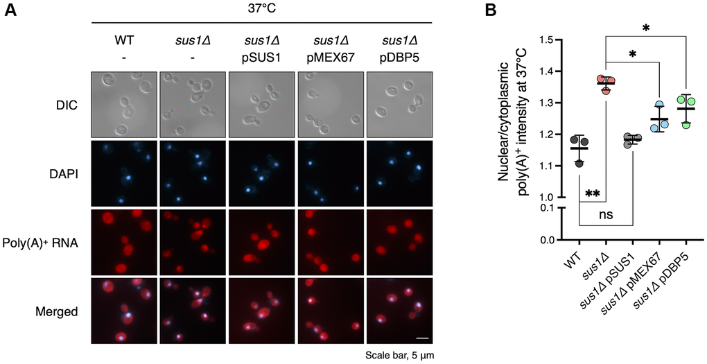 Increased doses of MEX67 or DBP5 restore the mRNA export defect in sus1Δ strains. (A) Representative images of FISH analysis for the WT and sus1Δ strains containing pRS316 expressing the indicated genes. Poly(A)+ RNAs were hybridized with Cy3-labeled oligo(dT) probes and visualized via fluorescence microscopy. DNA was stained with DAPI. DIC, DAPI, poly(A)+ RNA, and merged images are shown. (B) Quantitative analysis of the FISH results in (A). The nuclear poly(A)+ RNA intensity in each cell was divided by the cytoplasmic poly(A)+ RNA signal in the corresponding cell. Data are the mean ± SD of triplicate experiments. **P *P t-test between the indicated pairs of values).