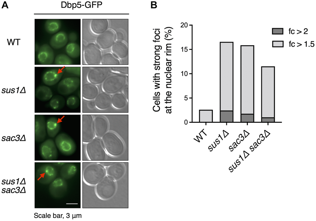 Dbp5 is mislocalized in sus1Δ cells. (A) Fluorescence microscopy analysis of Dbp5-GFP in WT cells and the indicated mutants. The left and right panels show GFP and DIC images, respectively. Red arrows indicate strong foci at the nuclear rim. (B) The percentage of cells containing strong Dbp5-GFP foci shown in (A). The ratio of the GFP intensity of each strong focus to that in the outer region of the strong focus was calculated. Light and dark gray color bars in the graph indicate the percentage of cells with >1.5- and 2-fold of the focus ratio, respectively.