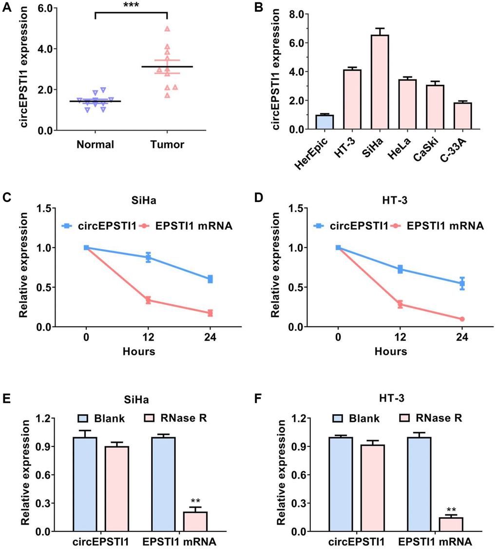 circEPSTI1 is upregulated in cervical cancer with circRNA features. (A) The contents of circEPSTI1 in ten paired cervical cancer samples and neighboring non-malignant tissues. (B) The relative contents of circEPSTI1 in normal HcerEpic cell line and cervical cancer cell lines. (C, D) Circular transcripts of circEPSTI1 were more stable, in contrast with that of linear EPSTI1 mRNA assessed via actinomycin D treated assay in SiHa and HT-3 cervical cancer cell lines. (E, F) The circular structure of circEPSTI1 was assessed via RNase R assay in SiHa, as well as HT-3 cell lines of cervical cancer. The analyzed gene was selected from the host genes of circEPSTI1 in cervical cancer tissues.