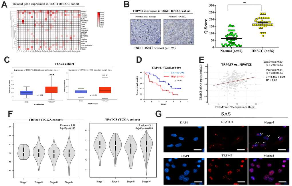 Expression and prognostic value of TRPM7 mRNA for HNSCC based on the TSGH and TCGA cohort. (A) Heatmap of TRPM7 expression in Tri-Service General Hospital (TSGH) patients with head and neck squamous cell carcinoma. (B) Immunostaining showed that TRPM7 expression in the tissues of HNSCC patients was higher than that in normal tissues. (C) Box-plot diagrams of TRPM7 and NFATC3 expression in TCGA. (D) Using the GSE26549 dataset (n = 44), we demonstrated that high TRPM7 mRNA expression is associated with worse 5-year overall survival compared with low TRPM7 mRNA expression. (D) Overall survival of HNSCC patients with a high NFATC2 expression had a poor overall survival rate from the TCGA cohort (E) A positive correlation was observed between the expression of the calcineurin/NFAT pathway-related targets NFATC3 and TRPM. (F) Expression analysis of TRPM7 and NFATC3 with tumor stage from the TCGA cohort (Image generated from: http://gepia2.cancer-pku.cn/#analysis). (G) Immunofluorescence assay to show the co-localization of TRPM7 and calcineurin/NFAT in SAS cells. *p 