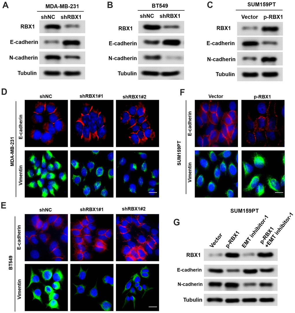 RBX1 exerts its oncogenic role by enhancing EMT in TNBC. (A, B) Western blot assay of the phenotypic markers of stable RBX1 silencing, containing N-cadherin and E-cadherin, in BT549 and MDA-MB-231 cells. Expression of tubulin was applied as a loading control. (C, D, F) Confocal microscopy assay of vimentin and E-cadherin in TNBC cells with the overexpression or knockdown of RBX1. Green and red signals reveal staining for the associated proteins, blue signal denotes the nuclear DNA staining for DAPI. (E) Western blot assay of the phenotypic markers, containing N-cadherin and E-cadherin in SUM159PT cells transfected with plasmid with the overexpression of RBX1. (G) Western blot assay of the phenotypic markers, containing N-cadherin and E-cadherin.