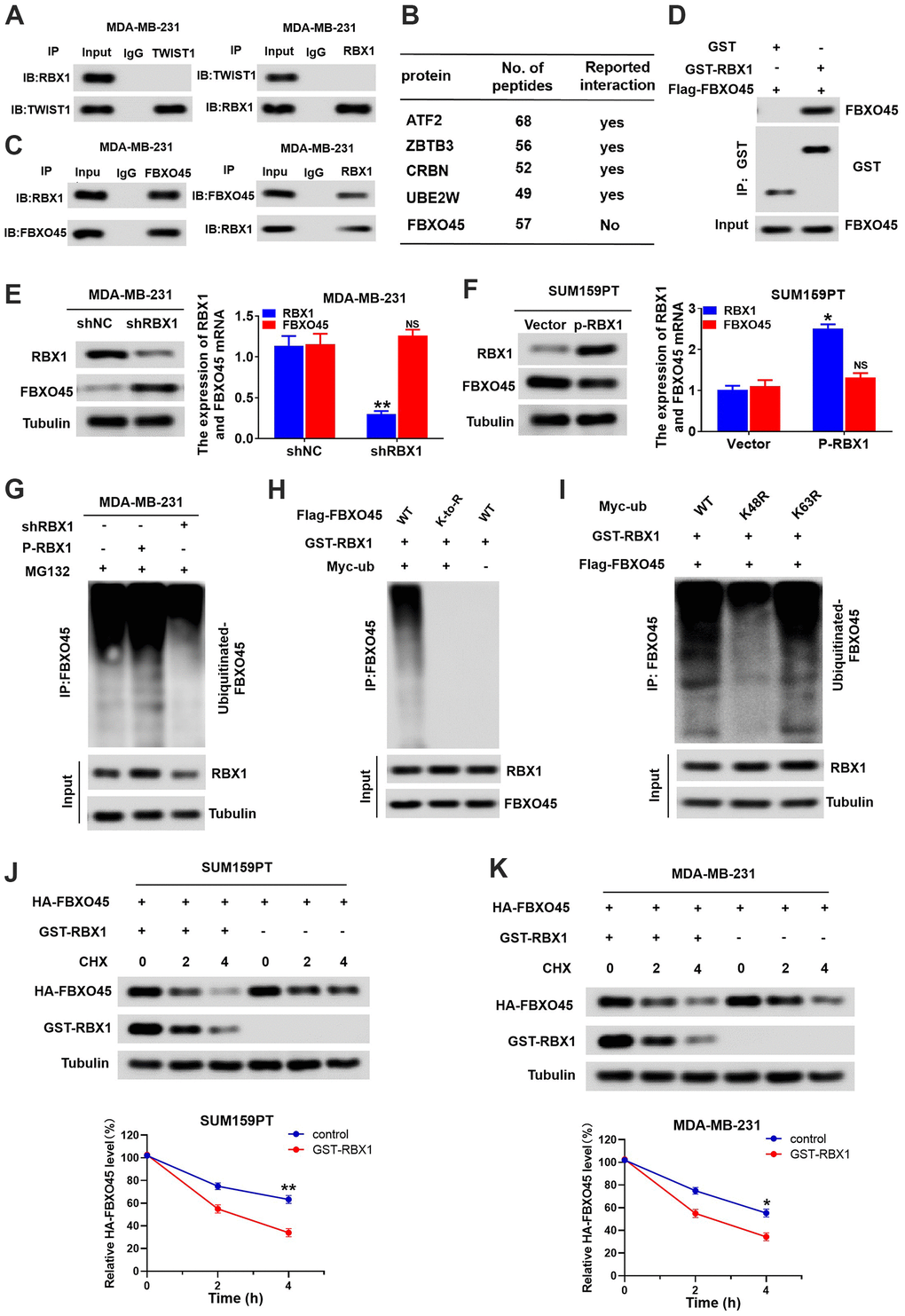 RBX1 promotes FBXO45 ubiquitination and degradation in TNBC cells. (A) Co-IP reveals no direct binding of endogenous TWIST1and RBX1. (B) Partial list of proteins related to RBX1, determined with immunoprecipitation-mass spectrometry. (C) Co-IP reflected direct binding of endogenous FBXO45 and RBX1 in the MDA-MB-231 cells. (D) GST pull-down analysis displaying direct binding of FBXO45 and RBX1. (E) qRT-PCR and western blotting exhibiting the FBXO45 and RBX1 expression levels in the RBX1-silencing MDA-MB-231 cells. **P F) The qRT-PCR and western blotting revealing the FBXO45 and RBX1 expression levels in SUM159PT cells stably transfected by plasmid with overexpression of RBX1. **P G) RBX1 exogenous expression or knockdown changed the FBXO45 ubiquitination. The proteasome suppressor MG132 was used to treat the cells from each group. Cell lysates were generated and next immunoprecipitated by an anti-FBXO45 antibody. Western blotting was applied for measuring the levels of ubiquitin-linked FBBXO45 utilizing anti-UB antibody. (H) Ubiquitination of wild-type FBBXO45 or K-to-R mutants (mutations in all Lys position of the FBBXO45 gene). (I) FBXO45 ubiquitination in the HEK293 cells was detected. (J, K) TNBC cells were transfected by plasmids encoding HA-FBXO45, without or with p-RBX1 plasmid. Cells were next exposed to 20μmol/L of cyclohexanone (CHX) at the given times, and the anti-HA antibody was utilized to determine FBXO45 degradation. *P P 