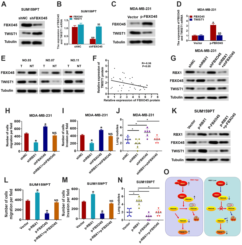 RBX1 promotes the TWIST1-mediated migration dependent on FBXO45. (A, B) The qRT-PCR and western blotting of the TWIST1 expression levels in the SUM159PT cells stably transfected by shFBXO45 or shNC plasmid. *P C, D) The qRT-PCR and western blotting of the TWIST1 expression levels in the MDA-MB-231 cells stably transfected by vector or plasmid with the overexpression of FBXO45. *P E) Western blotting was applied for detecting the levels of TWIST1 and FBXO45 protein in TNBC cancer tissues together with paired non-tumour tissues, 30 numbers in each group. Tubulin was utilized as a loading control. (F) Scatter plots of TWIST1 and FBXO45 protein expression in the TNBC. (G) Western blot of TWIST1, FBXO45, and RBX1 protein levels in the MDA-MB-231 cells stably transfected by shRBX1 with or without shFBXO45. The expression of tubulin was employed as a loading control. (H, I) Transwell analyses were implement to identify the MDA-MB-231 cells metastatic capacity that stably transfected by shRBX1 with or without shFBXO45. *P J) The data reflect the statistics of the number of nodules of lung metastases. *P K) Western blot of TWIST1, FBXO45, and RBX1 protein levels in the TNBC cells stably transfected by p-RBX1with or without p-FBXO45. The expression of tubulin was employed as a loading control. (L, M) Transwell analyses were implement to identify the TNBC cells metastatic capacity that stably transfected by p-RBX1 with or without p-FBXO45. *P N) The data display the statistics of the number of nodules of lung metastases. *P O) Schematic representation of E3 UB ligase RBX1 driving the transfer of TNBC via an FBXO45-TWIST1-dependent degradation mechanism.