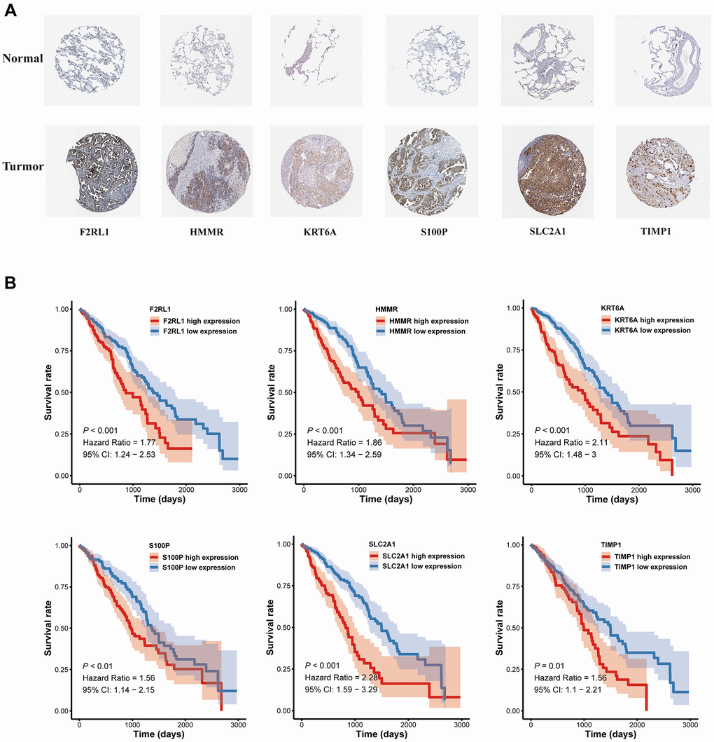 The expression and survival analyses of the six MAGs. (A) The representative protein expression of MAGs in lung adenocarcinoma tissue and normal tissue. (B) Kaplan-Meier survival analysis.