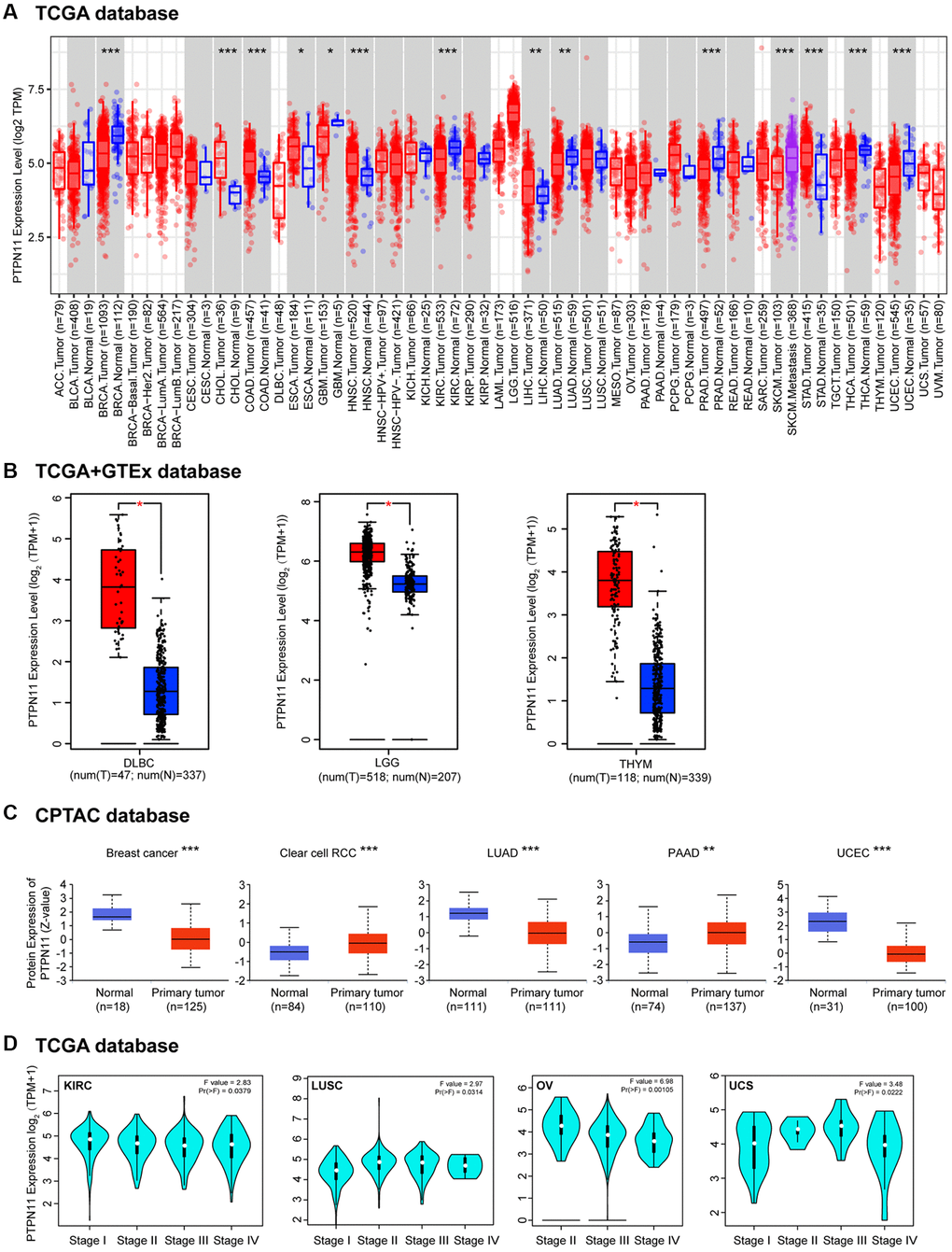 The differential expression of PTPN11 gene in various tumors and pathological phases. (A) The expression of PTPN11 gene in various cancers or specific subcategories of tumor. *p **p ***p B) The expression of PTPN11 in DLBC, LGG, and THYM in the TCGA project was compared with the comparable healthy tissues in the GTEx dataset. *p C) On the basis of the CPTAC database, the expression levels of PTPN11 total protein in healthy and primary tissues were evaluated for breast cancer, clear cell RCC, LUAD, PAAD, and UCEC. **p ***p D) According to TCGA data, the expression levels of PTPN11 were analyzed by the primary pathological stages (stages I, II, III, and IV) of KIRC, LUSC, OV, and UCS. For the log scale, Log2 (TPM + 1) was applied.