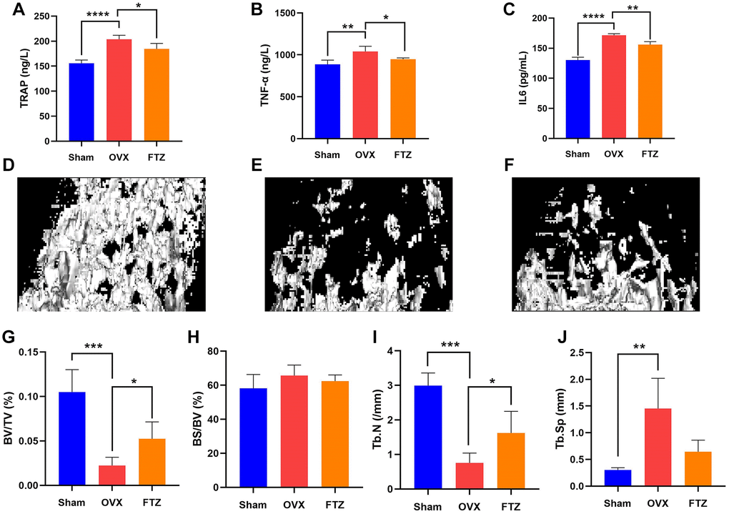 FTZ treatment improves ovariectomized (OVX)-induced bone loss in vivo. (A–C) Serum levels of TRAP, TNF-α, IL6 in different groups were detected by ELISA. (D–F) Representative μCT images showing the bone mass of Sham, OVX, FTZ groups, and indicating that the bone loss was prevented by FTZ treatment. (G–J) μCT quantitative parameters for bone microstructure including BV/TV, BS/BV, Tb.N, and Tb.Sp (n = 4 per group). *p **p ***p 