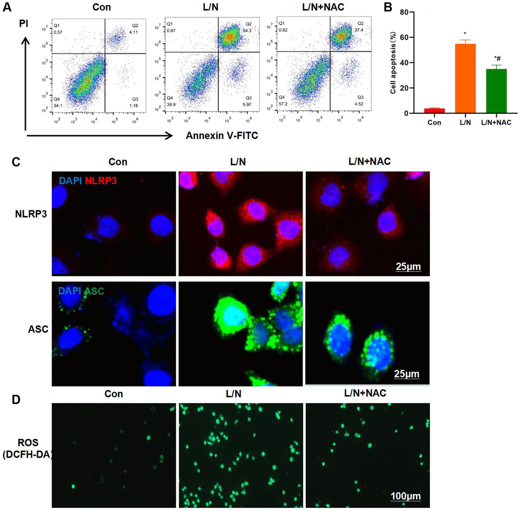 Suppressing ROS inhibits inflammatory response and injury in KCs. (A, B) Results of FCM assay (n = 3). The cell apoptosis level in L/N + NAC group was significantly down-regulated, lower than that in L/N group. *P #P C) IF staining results (n = 3). NAC suppressed the activation of NLRP3 inflammasome, and the expression levels of NLRP3 and ASC markedly decreased, lower than those in L/N group. (D) ROS detection by DCFH-DA probe (n = 3). NAC suppressed ROS expression, and the number of positive cells evidently decreased, lower than that in L/N group.