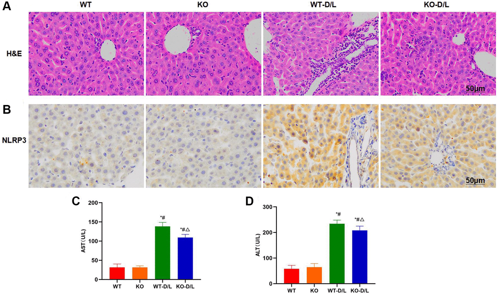 NOX4-KO suppresses liver injury in mice. (A) H&E staining (n = 5). Mice in KO and WT groups did not exhibit any obvious tissue injury, with no bubble-like structure or inflammatory response. Mice in WT-D/L group exhibited distinct inflammatory injury and obvious cell injury, along with inflammatory response. While tissue injury in KO-D/L group was alleviated. (B) Histochemical staining of NLRP3 (n = 5). NLRP3 expression dramatically increased in WT-D/L group, higher than that in WT and KO groups, while NLRP3 expression in WT and KO groups was relatively low, and that in KO-D/L group decreased. (C, D) Detection of ALT and AST levels (n = 5). ALT and AST levels dramatically decreased in KO-D/L group, lower than those in WT-D/L group. *P #P △P 