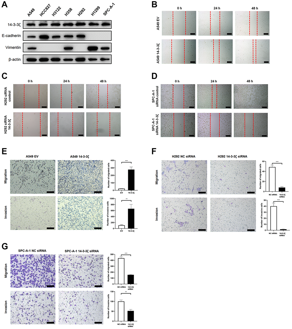 The 14-3-3ζ promotes NSCLC cell mobility, migration and invasion. (A) Western blot analysis of endogenous expression of 14-3-3ζ, E-cadherin and vimentin in a panel NSCLC cell lines. β-actin was used as equal loading control. (B–D) Evaluation of 14-3-3ζ on NSCLC cell mobility by wound healing assay. After indicated treatment, cells were seeded into 6-well plates and an artificial wound was created. Photographs were taken at indicated time points and representative images were shown. Scale bar = 100 μm. (E, F) The 14-3-3ζ was either overexpressed (E) or suppressed (F, G) in NSCLC cell lines, and the resultant cells were tested for migration and invasion capacity by transwell assay, respectively. Representative images at different time points were shown. Scale bar = 100 μm. The number of migrated and invaded cells was calculated and analyzed for statistical significance. **P ***P 