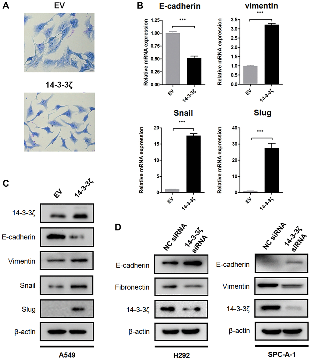 14-3-3ζ promotes NSCLC cells undergoing EMT. (A) Representative images of morphological changes in A549 cells overexpressing 14-3-3ζ. Scale bar = 200 μm. (B) Real time qPCR analysis of EMT biomarkers and transcriptional factors following upregulating 14-3-3ζ in A549 cells (***P C) Immunoblotting of E-cadherin, vimentin, Snail and Slug protein in the A549 EV and A549 14-3-3ζ cells, respectively. β-actin was used as equal loading control. (D) Immunoblotting of EMT biomarkers in NSCLC cells transfected with indicated siRNA. β-actin was used as equal loading control.