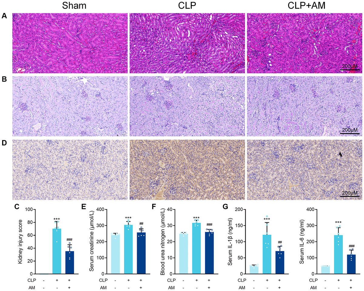 Protective effect of Astragalus membranaceus and Astragaloside IV in
