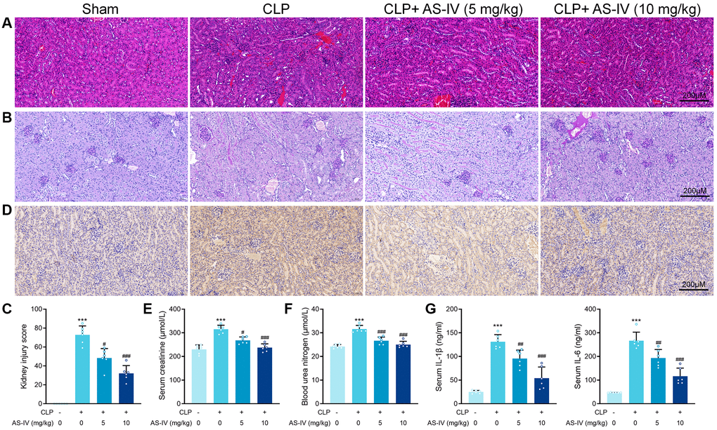 AS-IV protects against renal injury in CLP-induced sepsis. (A) Representative images of H&E staining of tubular epithelial cells of kidney sections obtained at 24 hours after CLP surgery following treatment with low (5 mg/kg) or high dosage (10 mg/kg) AS-IV. (B) Representative images of periodic acid Schiff’s staining reagent depicting basement membrane and brush border in the kidney sections. (C) Semiquantitative analysis of tubular injury. (D) Representative images showing KIM-1 immunohistochemical staining of the apical side of tubular epithelial cells. Serum creatinine (E) and Blood urea nitrogen (F) in mice were measured. (G) Serum IL-6 and IL-1β concentrations were measured by ELISA. Data are presented as the mean ± SEM (n = 6 per group, ***P #P ##P ###P 