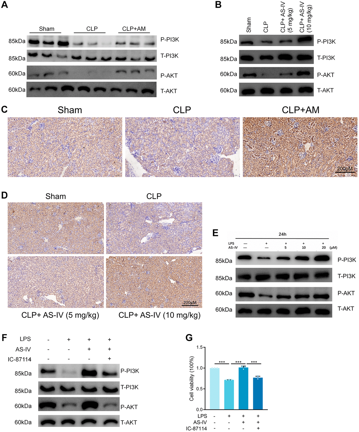 Protective effect of Astragalus membranaceus and Astragaloside IV in