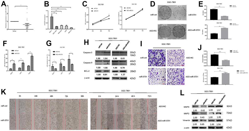 Expression and function of miR-5701 in GC cell line SGC-7901. (A) The expression of miR-5701 in GC tissues versus normal gastric tissues. (B) The expression of miR-5701 in GC cell lines. GES-1 was used as control. SGC-7901 cells were infected with miR-5701 or were treated with ASO-miR-5701. (C) Cell viability was measured by MTT assay at the time of 24h, 48h and 72h. (D, E) Cell proliferation was measured by colony formation assay; (F, G) Cell apoptosis was checked by flow cytometry; (H) Apoptosis-associated proteins were measured by Western blot; (I–L) Cell migration were measured by scratch assay and transwell assay, and migration associated proteins were measured by Western blot. Data are represented as the mean±SD and experiments were performed in triplicate; * p