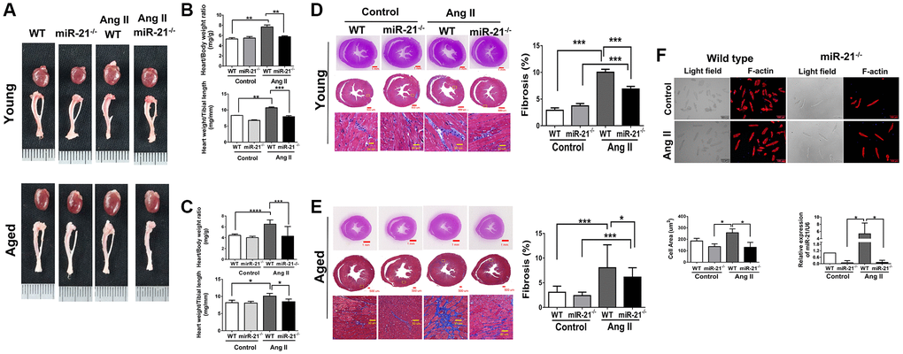 miR-21 knockout (miR-21−/−) decreased angiotensin II (Ang II)-induced cardiac hypertrophy and fibrosis in both young and aged mice. (A) Representative images of harvested hearts. Quantitative analysis of heart weight/body weight and heart weight/tibia length in wild type (WT) or miR-21−/− of (B) young and (C) aged mice. In WT or miR-21−/− of (D) young and (E) aged mice, representative sections of hearts stained with Masson's trichrome for fibrosis detection (blue); scale bars, 30 μm (left panel). Quantification of cardiac fibrosis (right panel). (F) miR-21−/− decreased Ang II-induced increased cardiac hypertrophy miR-21 expression in primary mouse cardiomyocyte. The representative merged images of light field and F-actin immunofluorescence staining for primary cardiomyocyte isolated from WT and miR-21−/− of young mice. The cell area was measured 100 random cells in each group. The expression of miR-21 was measured by qRT-PCR in each group. *P **P ***P N = 6–8).