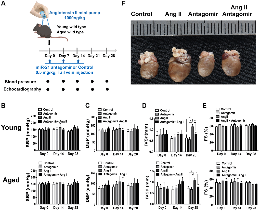 The treatment of miR-21 antagomir mitigated angiotensin II (Ang II)-induced cardiac hypertrophy, especially in the aged mice. (A) The study design investigating the effects of miR-21 antagomir in young (12 week-old) and aged mice(50 week-old) of Ang II-induced pressure overload. The sequential changes of (B) systolic, (C) diastolic blood pressures, echocardiography derived (D) intraventricular septal thickness at diastole (IVSd), and (E) fractional shortening (FS) in young and old mice treated with miR-21 antagomir or not under Ang II-induced pressure overload. (F) The comparison of harvested hearts in mice of control, Ang II, miR-21 antagomir and Ang II+ miR-21 antagomir. *P N = 4–6).