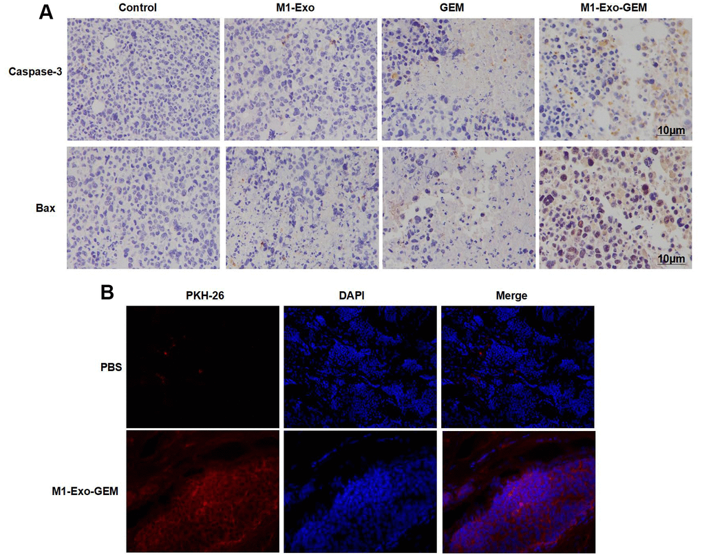 Effect of M1-Exo-GEM on tumor apoptosis in tumor-bearing mice. (A) In IHC staining, Caspase-3 and Bax were negatively expressed in the Control group. In the M1-Exo and GEM groups, these expressions were significantly up-regulated, where pathological changes of tissue damage occurred. In the M1-Exo-GEM group, Caspase-3 and Bax expressions were significantly up-regulated, showing higher levels than those in the M1-Exo and GEM groups. (B) PHK-67 tracing of Exos revealed enrichment of M1-Exo-GEM in tumor tissues, indicating that tumor tissues could take up Exos.