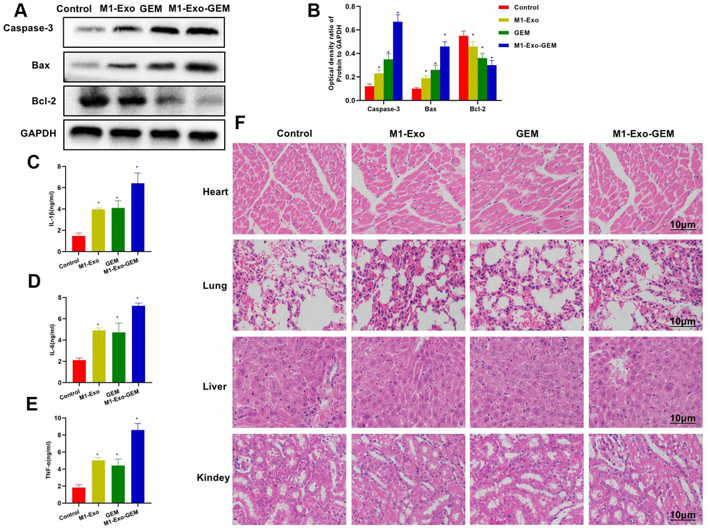 Effect of M1-Exo-GEM on tumor apoptosis in tumor-bearing mice. (A, B) In the protein assay, Bcl-2 was overexpressed in the Control group, while Caspase-3 and Bax were under expressed. GEM and M1-Exo enhanced the expressions of Caspase-3 and Bax and inhibited the Bcl-2expression, suggesting their pro-apoptosis activities. M1-Exo-GEM could further promote the apoptosis signal activation. *PB–E) In the detection of tissue inflammatory cytokines, the TNF-α, IL-6 and IL-1β were lowly expressed in the Control group. M1-Exo and GEM enhanced the expressions of these inflammatory cytokines, whose levels were significantly higher than the Control group. M1-Exo-GEM could further up-regulate the inflammatory cytokine levels. *PF) According to the H&E staining results for pathological examination of mouse heart, liver, lung and kidney, M1-Exo-GEM had no toxic effect on other organs. No obvious pathological changes were observed in the organs or tissues, which were in a normal physiological state.