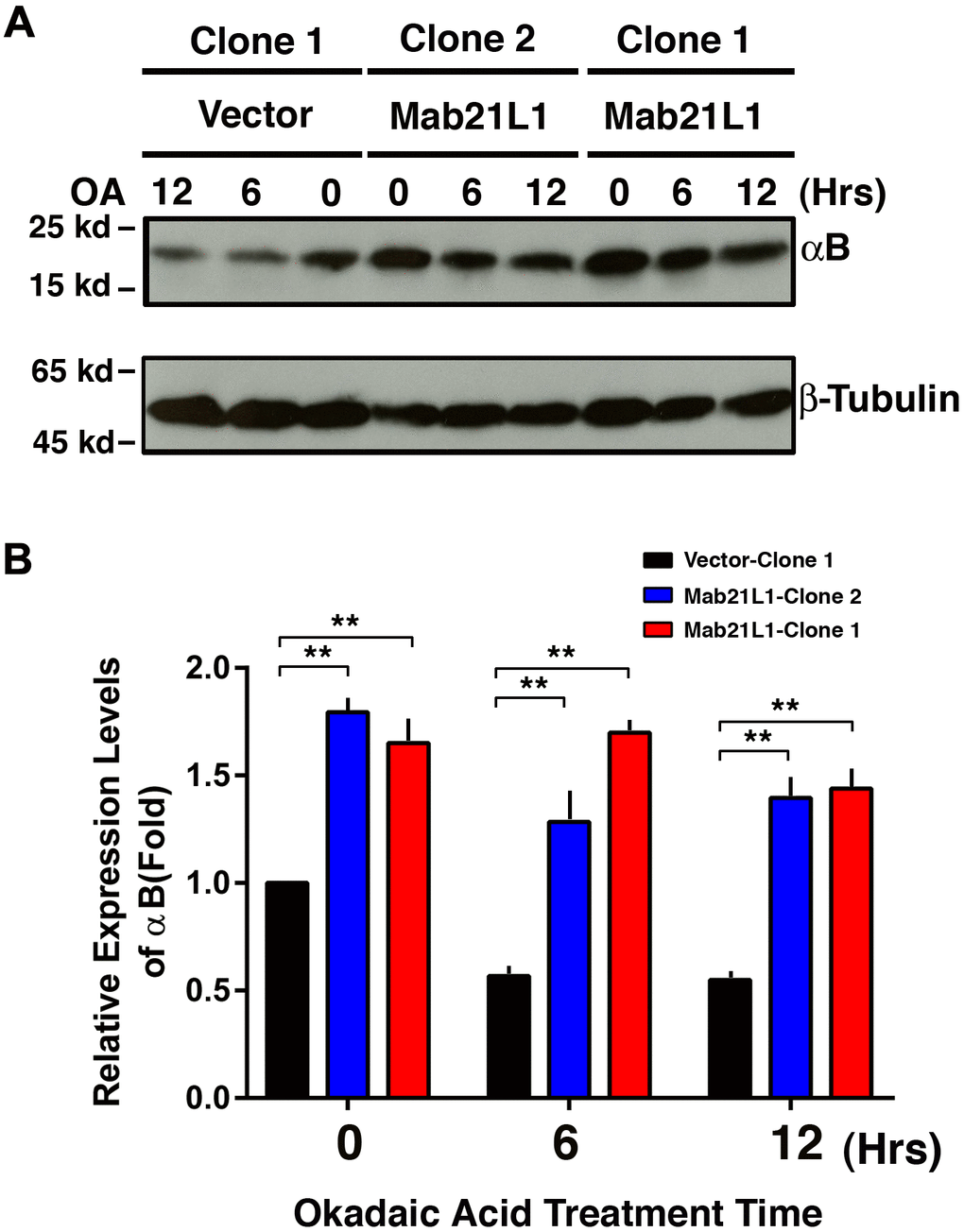Upregulation of αB-crystallin in Mab21L1-αTN4-1 cells and its attenuated degradation during okadaic acid (OA)-induced apoptosis of the Mab21L1-αTN4-1 cells. Both vector-αTN4-1 and MAB21L1-αTN4-1 cells were grown to about 90% confluence and then subjected to 100 nM OA treatment for 12 and 24 hrs. Thereafter, the cells were harvested for extraction of total proteins which were used for analysis of αB-crystallin expression by Western blot analysis (A). Quantitative results of the αB-crystallin protein expression levels were analyzed by Image J software (B). Note that in the MAB21L1-αTN4-1 cell clones, the αB-crystallin protein expression level was much higher than that in the vector-αTN4-1 cell clone in the absence of 100 nM OA treatment. During OA treatment for 12 and 24 hrs, the degradation of αB-crystallin protein was much slower in MAB21L1-αTN4-1 cell clones than that in vector-αTN4-1 clone. N=3. ** p
