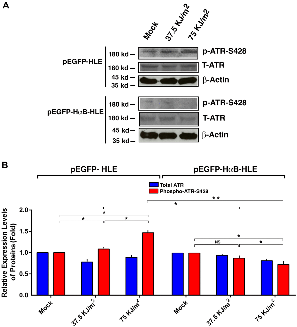 αB-crystallin inhibited ATR activation under the UVA irradiation. Both pEGFP-HLE and pEGFP-HαB-HLE cells (Mao et al., 2004) were grown to 90% confluence, then subjected to mock irradiation, 37.5 KJ/m2 and 75 KJ/m2 UVA irradiation, respectively. The irradiated cells were harvested for extraction of total proteins which were used for analysis of total ATR (T-ATR, 300 kd), phosphorylated ATR at S-428 and β-Actin (loading control) by Western blot analysis (A). Quantitative results of the T-ATR, and p-ATR-S428 levels against loading control in pEGFP-HLE cells and pEGFP-HαB-HLE cells (B) were analyzed by Image J software. Note that UVA induced significant upregulation of ATR activity (as reflected by phosphorylation at S428) in pEGFP-HLE cells. In contrast, in pEGFP-HαB-HLE cells, both total ATR and phosphorylated ATR at S428 were downregulated under UVA irradiation. N=3. NS, not significant. *p