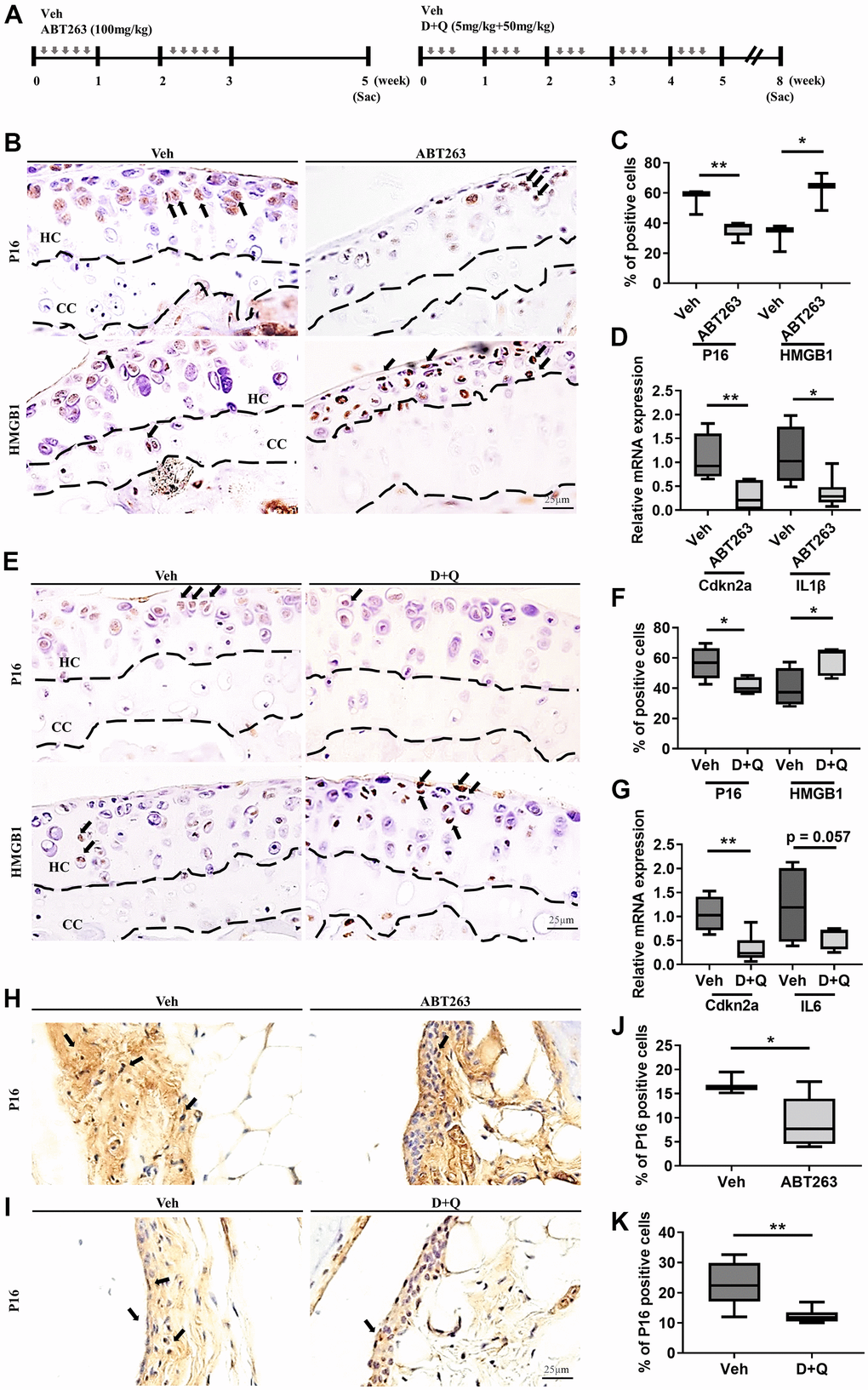 ABT263 and D+Q deplete senescent cells in articular joints of aged mice. (A) Timeline of the ABT263 and Dasatinib (D) + Quercetin (Q) treated aged mouse model of spontaneous OA. We orally administered ABT263 at 100 mg/kg or Vehicle (Veh) to 21 to 22-month-old mice five times biweekly for 4 weeks. The 21 to 22-month-old mice were given oral D + Q (5 mg/kg Dasatinib plus 50 mg/kg Quercetin) or Veh three times every week for 5 weeks. (B) Representative immunostaining images of p16 and HMGB1 + cells (arrows) in the articular cartilage of the ABT263 or Veh-treated aged mice. HC, hyaline cartilage; CC, calcified cartilage. (C) Quantification of p16 + SnCs and non-SnCs positive for nuclear HMGB1 in the articular cartilage (n = 3 mice for Veh, n = 5 mice for ABT263). (D) mRNA expression levels of Cdkn2a and IL1β are validated by qRT-PCR analysis in the aged mice administered ABT263 or Veh (n = 4 for Veh, n = 7 for ABT263). (E) Representative immunostaining for p16 and HMGB1 positive cells (arrows) in the articular cartilage of D+Q or Veh treated aged mice. (F) Quantification of p16 and HMGB1 + cells in the articular cartilage (n = 5 per group). (G) Quantification of mRNA levels for Cdkn2a and IL6 by qRT-PCR in the joints of D+Q or Veh-treated aged mice (n = 4 for Veh, n = 7 for D+Q). Representative images of immunostaining for p16 in the synovium of (H) ABT263 or Veh-treated or (I) D+Q or Veh-treated in the articular knee joint of the aged mice. Percentage of p16+ cells in the synovial membrane of (J) ABT263 or Veh-treated (n = 3 for Veh, n = 6 for ABT263) or (K) D+Q or Veh-treated mice (n = 5 for Veh, n = 6 for D+Q). Whisker plots represent the 10th and 90th percentiles, and the line corresponds to the median. * p 