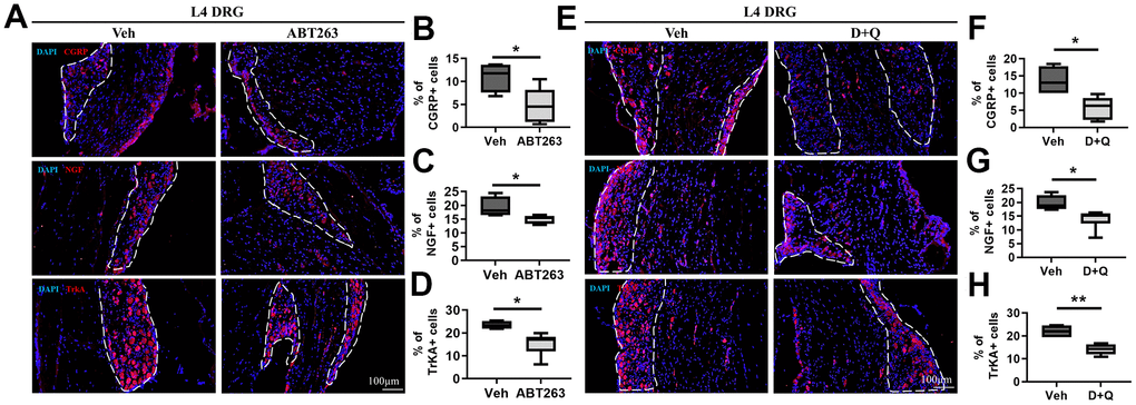 ABT263 and D+Q decreased pain-related activation of DRG neurons in age-associated OA mice. (A) Representative immunofluorescence images for CGRP, NGF, and TrkA of L4 DRG in 21 to 22-month-old mice administered by ABT263 or Veh. White dots indicate a DRG region. (B–D) Quantitative analysis of CGRP+ (n = 4 mice for Veh, n = 6 mice for ABT263), NGF+ (n = 4 for Veh, n = 5 for ABT263), and TrkA+ neurons (n = 4 for Veh, n = 6 for ABT263) in L4 DRG of ABT263 or Veh-treated aged mice. (E) Immunofluorescence analysis of CGRP +, NGF+, and TrkA+ neurons (red) in L4 DRG of D+Q or Veh-treated aged mice. (F–H) Quantification of CGRP+, NGF+, and TrkA+ neurons in L4 DRG of D+Q or Veh-treated aged mice (n = 4 for Veh, n = 6 for D+Q). Whisker plots represent the 10th and 90th percentiles, and the line corresponds to the median. Unpaired Student t-test was used for statistical analysis. * p 