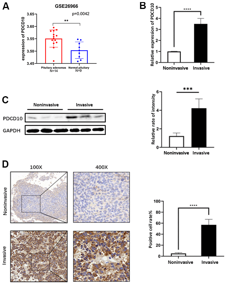 Expression of PDCD10 in human pituitary adenomas. (A) A dataset (GSE26966) was obtained from the GEO database to compare the mRNA expression level of PDCD10 between PA tumor tissues (N=14) and normal pituitary tissue (N=9). (B) Relative mRNA expression levels of PDCD10 by RT-qPCR in invasive (n=15) and non-invasive (n=15) pituitary adenomas. Non-invasive values were set to 1. (C) Representative Western blots showed the expression level of PCDC10 protein (25 kDa) in invasive and noninvasive pituitary adenomas. Band intensities were quantified and normalized to GAPDH. (D) Representative images of immunohistochemistry evaluated the expression of PDCD10 in invasive and non-invasive (n=15) pituitary adenomas. **P 