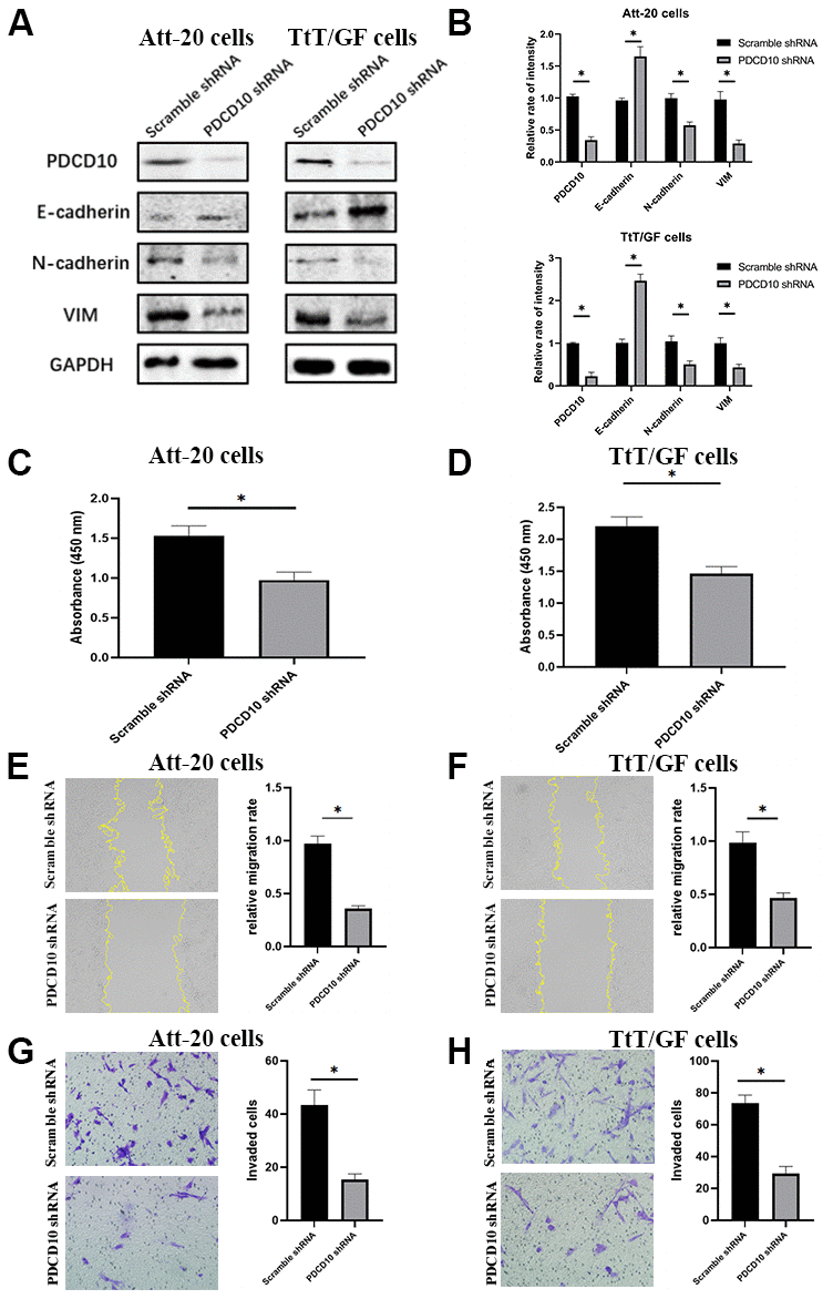 PDCD10 silencing suppresses the proliferation, migration, invasion and EMT of PA cells. (A) Western blotting was performed to detect the impact of PDCD10 silencing on the expression of EMT markers in Att-20 cells and TtT/GF cells. (B) Band intensities were quantified and normalized to GAPDH. (C, D) CCK-8 assay was used to assess cell proliferation capacity after PDCD10 silencing in Att-20 and TtT/GF cells. (E, F) Scratch assay was used to examine the relative migration rates of Att-20 and TtT/GF cells (magnification:100x). (G, H) Transwell invasion assay was used to analyze the invasion potential of Att-20 and TtT/GF cells (magnification: 200x). * P 