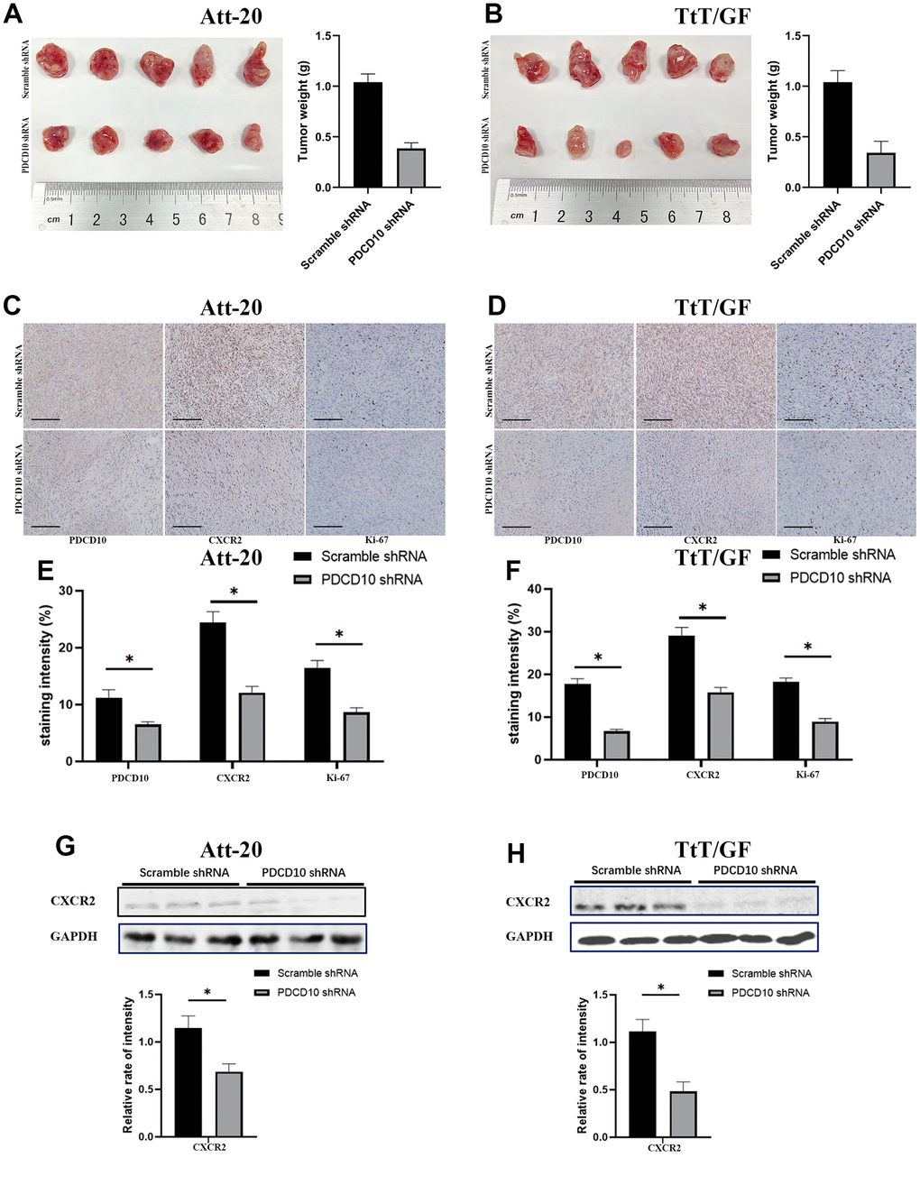 PDCD10 silencing impairs the tumorigenesis and reduces CXCR2 expression of PA cells in vivo. (A, B) Images for Att-20 and TtT/GF xenografts from nude mice (Left). Statistical analysis of xenograft tumor weights (Right). (C, D) Representative IHC images of Att-20 and TtT/GF xenograft tumor tissues for PDCD10, CXCR2 and Ki-67 staining (200x). Scale bars: 100μm. (E, F) Intensity of PDCD10, CXCR2 and Ki-67 staining were analyzed by IHC-Profiler. (G, H) Western blotting was performed to examine the expression of CXCR2 in Att-20 and TtT/GF xenograft tumor samples. Band intensities were quantified and normalized to GAPDH. * P 