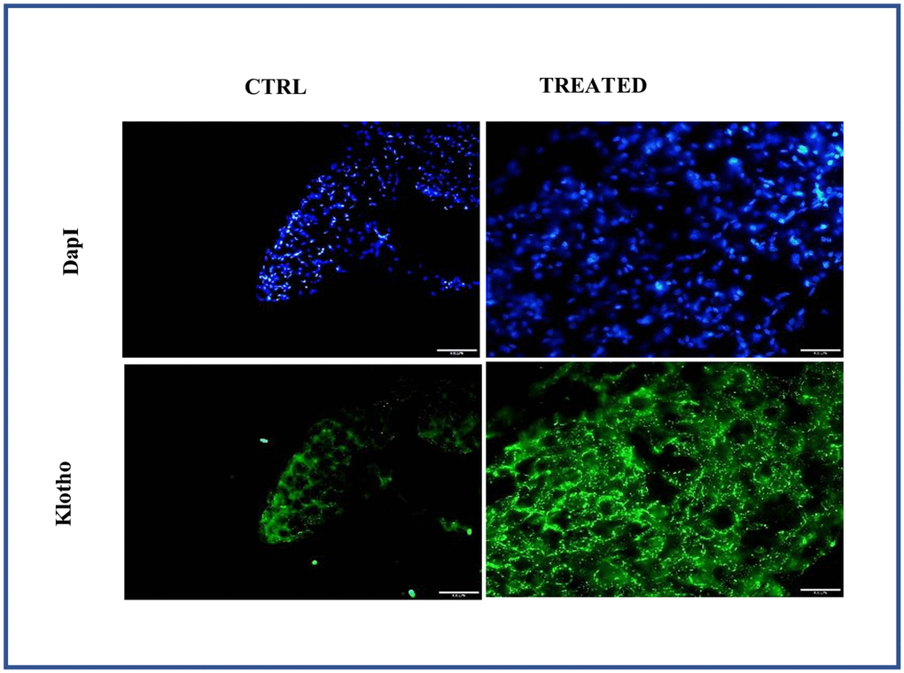 Effect of Artemisia argyi water extract (AAW) on pericardial adipose tissue. Tissue staining was performed to analyze the expression of Klotho. Adipose tissue isolated from rat were stained with anti-Klotho (green) antibodies. Klotho expression has improved in AAW treated group.