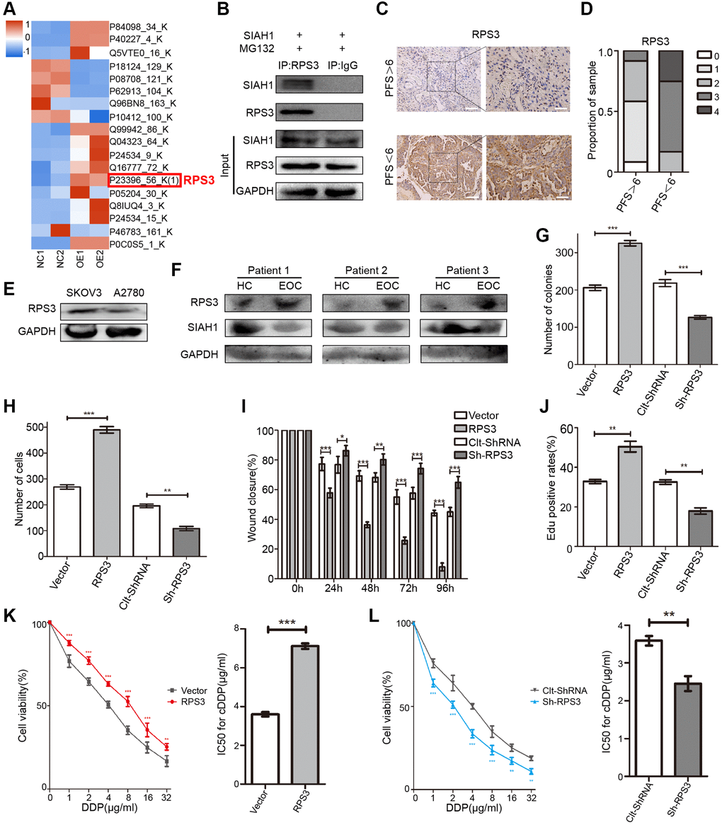 Identification of RPS3 as an interaction partner of SIAH1. (A) The heatmap showed that the protein level of RPS3 was down-regulated after SIAH1 overexpression in EOC cells. (B) Pull down of the RPS3 protein with SIAH1 antibody and IgG antibody in A2780 cells transfected with SIAH1. Cells were treated with 10 μM MG132 for 6 h before cell lysis. (C) Representative images of immunohistochemical staining for RPS3 in tumour specimens from ovarian cancer patients with PFS > 6 months vs. PFS D) The staining was assessed and scored on a scale of 0 (75% staining). The quantification of IHC staining (n = 24; PFS > 6, n = 12; PFS n = 12) was shown. (E) Protein level of RPS3 in SKOV3 and A2780 cells. (F) Protein levels of SIAH1 and RPS3 in serum samples from healthy controls (HC) and EOC patients (EOC). A2780 cells were separately transfected with Vector, RPS3, Clt-shRNA and sh-RPS3 for 48 h, the number of Cell Colonies was determined (G), the cell number from the Transwell assay was obtained (H), the Wound closure percentage was calculated (0, 24, 48, 72 and 96 h) (I), and the Edu positive rates (J), Cell Viability (K, L left panels), IC50 for cDDP (K, L right panels) were obtained. *p **p ***p 