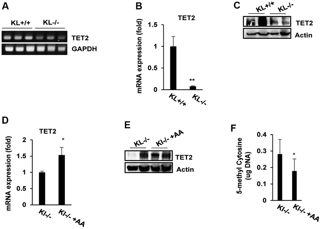 The expression of TET2 and DNA methylation status in ascorbic acid-treated SAMP1/kl-/- mice. (A, B) Endogenous TET2 mRNA expression in the salivary glands of SAMP1/kl+/+ and SAMP1/kl-/- mice was measured by RT–PCR or qRT–PCR. GAPDH was used as an internal control. **p C) The relative expression levels of TET2 protein in the salivary glands between SAMP1/kl +/+ and SAMP1/kl -/- mice were analyzed by Western blotting. (D, E) SAMP1/kl -/- mice (4 weeks old) were randomly divided into two groups (5 mice/group) and orally injected with ascorbic acid (100 mg/kg) or the same volume of saline for 18 days. After treatment, mouse salivary glands were collected and used for the following assays. The expression of TET2 mRNA and protein was determined by qRT–PCR (D) and Western blotting (E). (F) Quantitative analysis of 5-mC levels. Total 5-mC levels in salivary glands isolated from SAMP1/kl -/- mice and SAMP1/kl -/- mice treated with ascorbic acid were measured. *p 