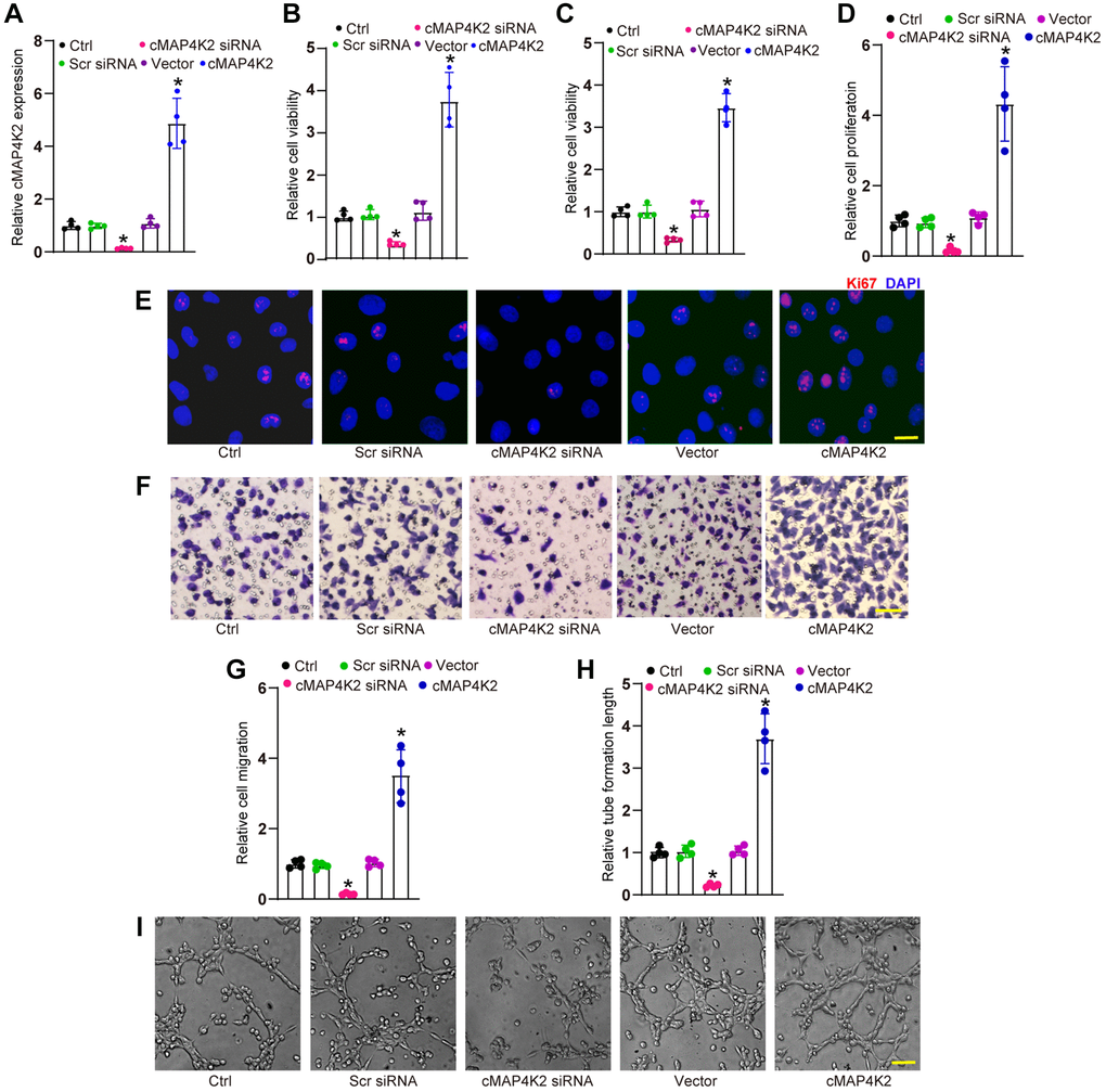 cMAP4K2 regulates endothelial angiogenic effects in vitro. (A) HRVECs were transfected with scramble (Scr) siRNA, cMAP4K2 siRNA, null vector, cMAP4K2 overexpressed vector, or left untreated (Ctrl) for 24 h. qRT-PCRs were performed to detect the expression levels of cMAP4K2 (n = 4, *P B and C) MTT and CCK-8 assays were performed to detect cell viability (n = 4, *P D and E) Ki67 staining assays were performed to detect cell proliferation (n = 4, *P F and G) Transwell assay was performed to detect the migratory ability of HRVECs (n = 4, *P H and I) The tube-like structures were observed at 6 h after seeding HRVECs on the Matrigel matrix. The cumulative tube lengths for each field were statistically analyzed (n = 4, *P 