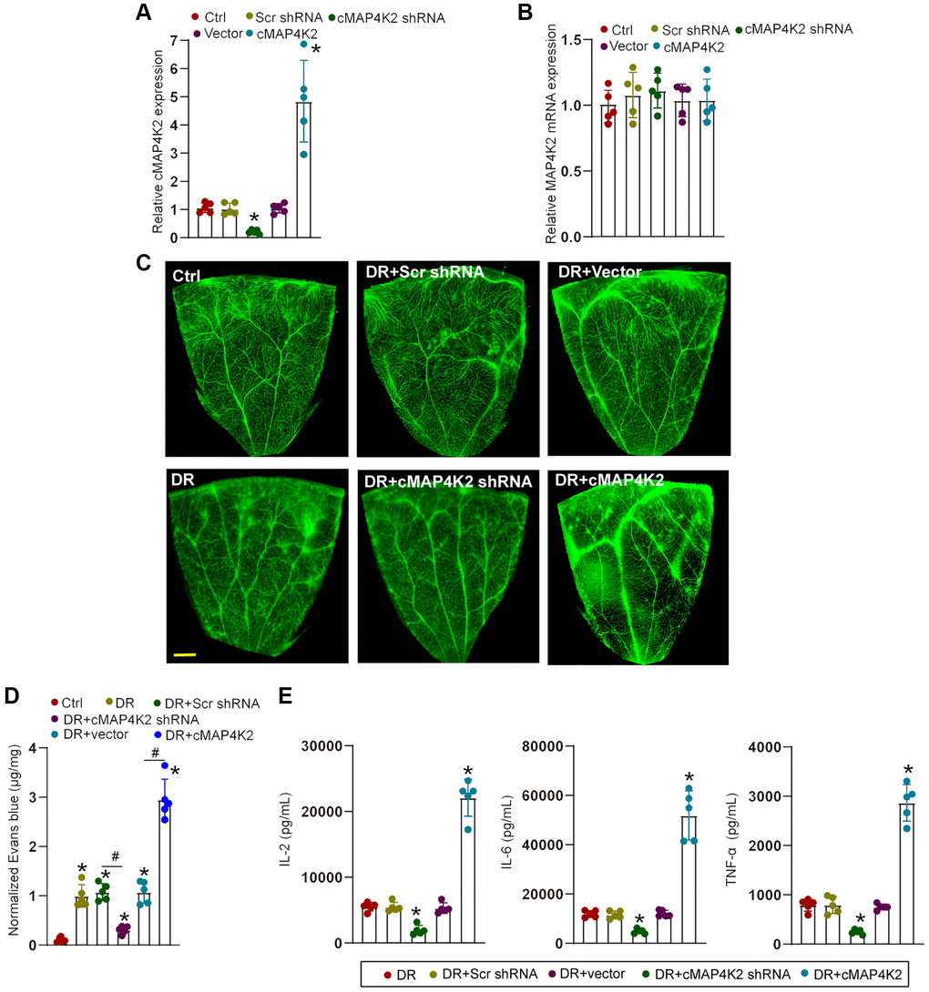 cMAP4K2 regulates retinal vascular dysfunction in DR. (A and B) C57BL/6 mice received an intraocular injection of scramble (Scr) shRNA, cMAP4K2 shRNA, null vector, cMAP4K2 overexpressed vector, or left untreated (Ctrl) for 2 weeks. qRT-PCR assays were performed to detect the expression levels of cMAP4K2 and MAP4K2 mRNA (n = 5, *P C and D) The mice were infused with Evans blue dye for 2 h. The fluorescence signal of flat-mounted retina was observed. A representative image and the quantification of Evans blue leakage was shown. Scale bar: 500 μm. (E) ELISA assays were performed to examine the amount of IL-2, IL-6, and TNF-α in retinal lysates among different groups (n = 5; *P #P 