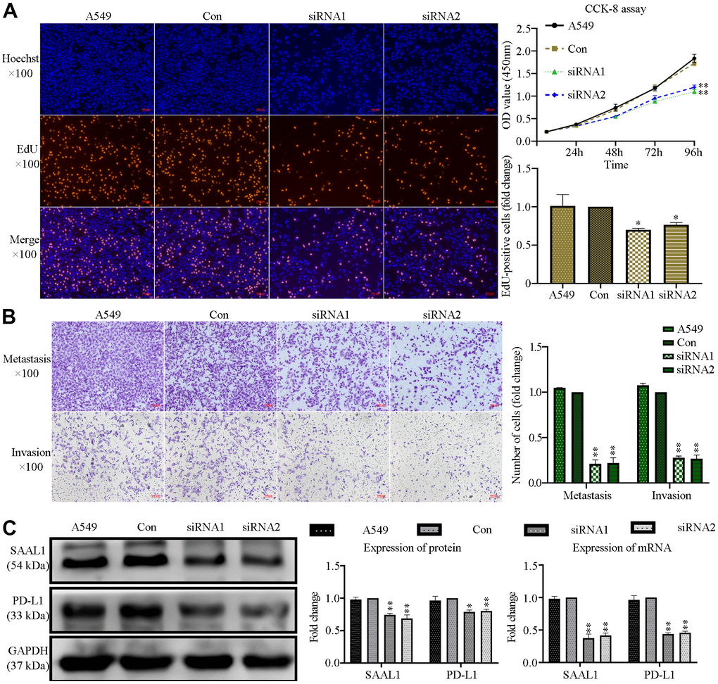 SAAL1 silencing inhibits proliferation, migration, and invasion and downregulates PD-L1 expression in lung cancer cells. A549 cells were transfected with control or SAAL1-targeting siRNAs (siRNA1 and siRNA2). (A) EdU and CCK-8 proliferation assay results. (B) Transwell migration and invasion assay results. (C) Western blotting and RT-qPCR analysis of SAAL1 and PD-L1 expression. GAPDH was used as the loading control. *P