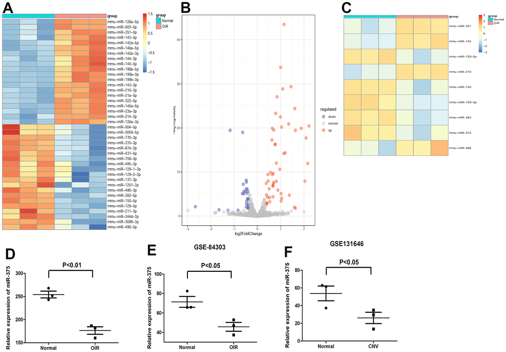 Expression of miR-375 is decreased in the retina of OIR. (A, B) A heat map (A) of the significantly differentially expressed microRNAs and the volcano plots (B) between groups. (C) A heat map of the differentially expressed microRNAs, which were consistent with our results, in the retina of OIR from GSE84303. (D, E) miR-375 was significantly downregulated in the retina of OIR group compared with that of the control group both in our samples (D) and in GSE84303 (E). (F) Expression of miR-375 was down-regulated in the retina of CNV. *P 