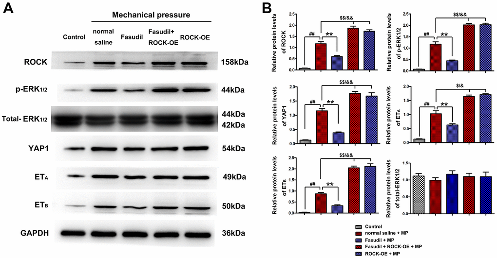 Fasudil suppressed the YAP/ERK/ETA/ETB signaling pathway in HA spasm by inhibiting ROCK activation. (A) Western blotting showed that Fasudil injection decreased the expressions of ROCK, p-ERK1/2, YAP1, ETA, and ETB under mechanical pressure stimulated human vascular smooth muscle cells. The decreased expressions of ROCK, p-ERK1/2, YAP1, ETA, and ETB in Fasudil group were restored by ROCK-OE. (B) The quantitative analysis of relative protein levels uncovered that the expressions of ROCK, p-ERK1/2, YAP1, ETA, and ETB were increased in Fasudil group compared with those in Model group or Sham group. All Pvs. Model group or Sham group. The relative protein levels of ROCK, p-ERK1/2, YAP1, ETA, and ETB in Fasudil group were restored by ROCK-OE Lentivirus.