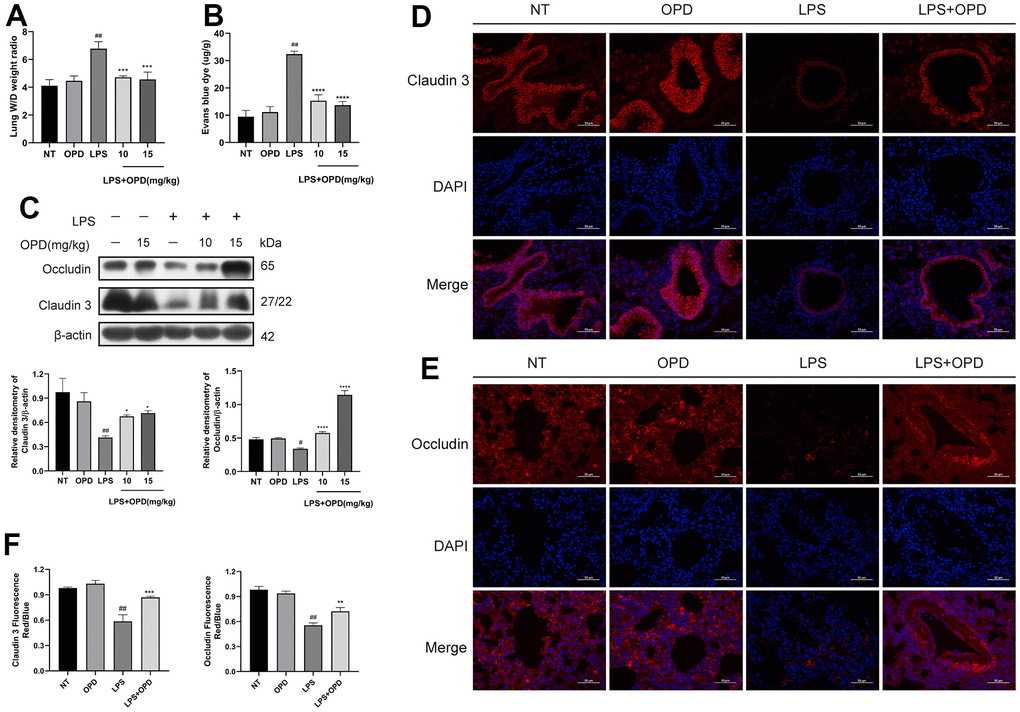 Oxypeucedanin maintains the integrity of the lung air-blood barrier in LPS-induced mice. LPS solution was dripped into one nostril of each mouse to establish the ALI model. Twelve hours later, a sample of mouse lung tissue was collected. OPD (10 and 15 mg/kg) was administered by intraperitoneal injection 1 h before the model was constructed. (A) The ratio of wet weight to dry weight of lung tissue. The lung wet/dry weight ratio was determined by the aforementioned method (n=5). (B) The mice were administered a tail vein injection of 1% Evans Blue (40 mg/kg, Sigma–Aldrich, MO, USA) 2 h before euthanasia. The measurement was then performed according to the method mentioned earlier. Pulmonary vascular permeability was observed by the increase in Evans blue dye in the lung tissue (n=5). (C) Protein levels of Occludin and Claudin 3 in LPS-treated mice (n=3). Quantitative analysis of Occludin and Claudin 3 proteins by ImageJ. (D–F) Immunofluorescence of Occludin and Claudin 3 proteins in lung tissue. Red indicates Occludin and Claudin 3 proteins, and blue indicates DAPI. Scale bar = 50 μm (n=3). Quantitative analysis of fluorescent pictures of Occludin and Claudin 3 by ImageJ. The concentration of the OPD animal experiment was 15mg/kg. SEM was used as the error standard for data analysis, and the experiment was repeated three times independently. #p ##p *p  0.05, **p  0.01 and ****p  0.0001 compared with the LPS group. LPS: Lipopolysaccharide; OPD: Oxypeucedanin; W/D: Wet/Dry weight.