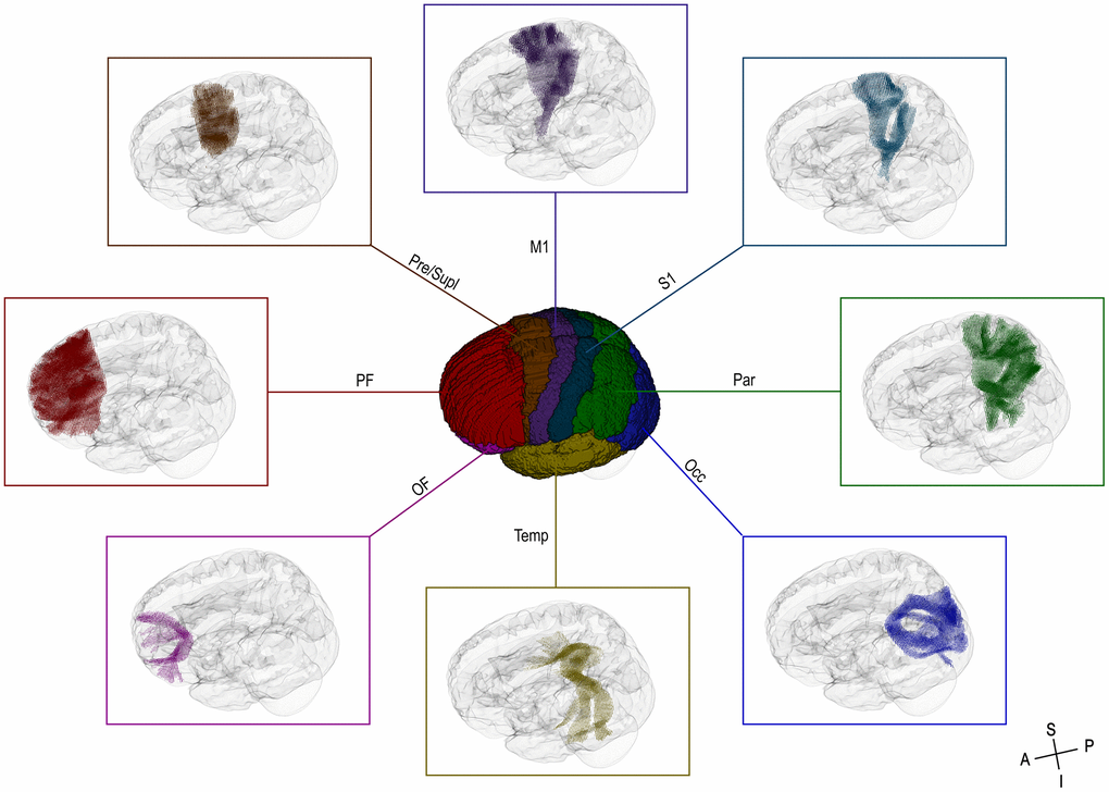 3D-view of the cortical regions of interest (ROIs) used for the targeted CC tractography (center) and the assigned fixels of interest (surround). OF = orbitofrontal cortex, PF = prefrontal cortex, Pre/Supl = premotor and supplementary cortex, M1 = primary motor cortex, S1 = primary sensory cortex, Par = parietal cortex, Occ = occipital cortex, Temp = temporal cortex, A = anterior, P = posterior, S = superior, I = inferior.