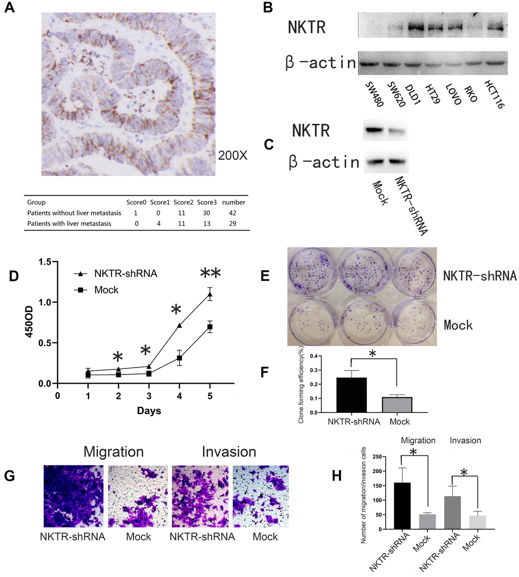 (A) Immunohistochemical staining and assessment of NKTR in primary CRC tissue. (B) Western blot showed NKTR expression in seven CRC cell lines. β-actin was used as an internal control. (C) Western blot showed NKTR expression in DLD1-NKTR-shRNA and mock. (D) Effect of NKTR expression of DLD1 cell proliferation. Error bars indicate s.e.m., n = 3. *P t-test). (E, F) Effect of NKTR expression on DLD1 cell colony formation. Error bars indicate s.e.m., n = 3. **P t-test). (G, H) Effect of NKTR expression on DLD1 cell migration and invasion. Data are representative of each group or expressed as the mean ± s.e.m. of cells per six high power fields. *P t-test).