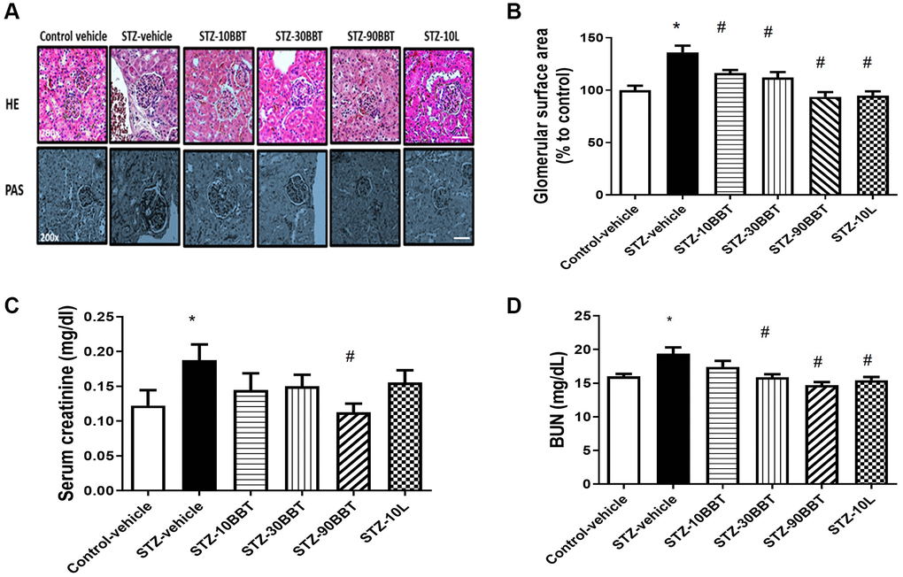 BBT-877 reduces glomerular injury in the kidneys of STZ induced diabetic mice. After treatment with BBT-877 for 8 weeks, mice were sacrificed and their kidneys were collected, fixed in 10% formalin buffer, and embedded in paraffin. The kidney sections were stained with hematoxylin and eosin (HE) and Periodic acid-Schiff (PAS). Glomerular surface area was quantified using 30 glomeruli per mouse by ImageJ Software. (A) Representative image of HE and PAS staining, scale bars = 20 μm (B) Glomerular surface area, (C) Serum creatinine, (D) Blood urea nitrogen. Abbreviation: STZ: streptozotocin. STZ-10BBT: BBT-877 10 mg/kg, STZ-30BBT: BBT-877 30 mg/kg, STZ-90BBT: BBT-877 90 mg/kg, STZ-10L: losartan 10 mg/kg. *p #p n = 8−10.