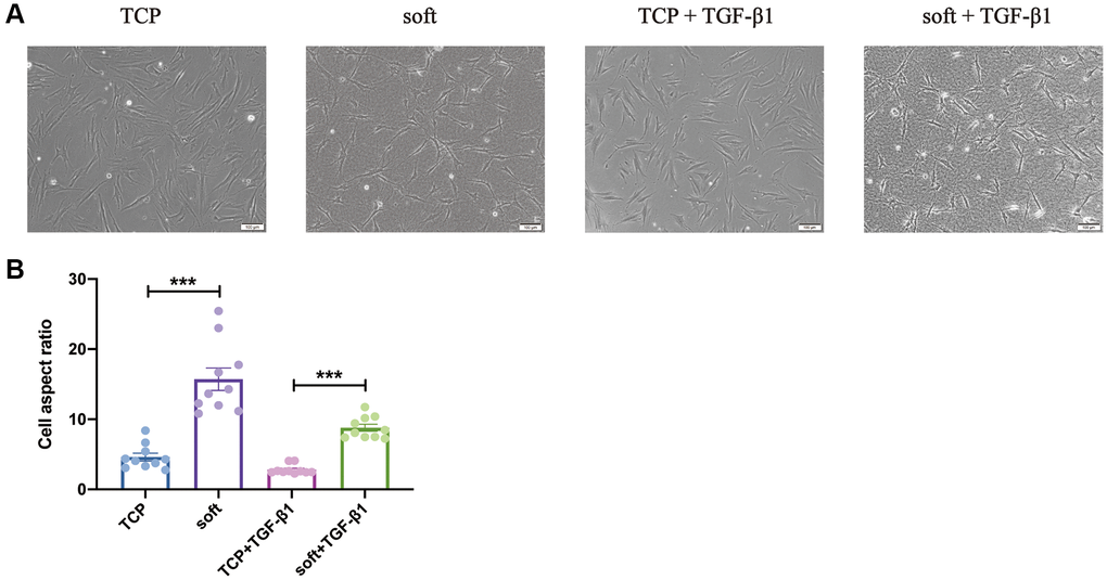 Soft substrates promoted aspect ratio of hFFs. (A) Phase-contrast images of hFFs on TCP and soft substrates with or without TGF-β1 at day 1. Scale bars: 200 μm (up) or 100 μm (down). (B) Aspect ratio of hFFs on TCP and soft substrates with or without TGF-β1 at day 1. ***P n = 10).