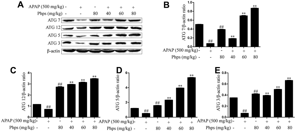 Phps enhanced the expression of ATG7, ATG12, ATG5 and ATG3 in APAP-induced acute liver injury of mice. The mice were received Phps (40, 60, 80 mg/kg) prior 1h APAP (500 mg/kg) injection and liver was collected for Western blot. (A), the expression of ATG7, ATG12, ATG5 and ATG3 in liver of mice. (B–E), Relative expression levels of all protein of all proteins including ATG7, ATG12, ATG5 and ATG3. All data are presented as mean ± SD (three independent experiments). #p ##p p p 