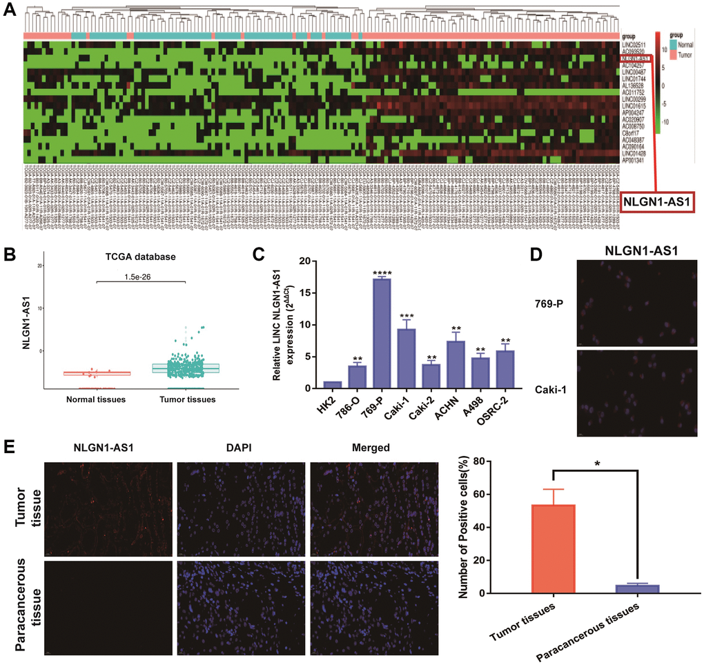 NLGN1-AS1 is a novel lncRNA involved in renal malignant transformation. (A) The heatmap of 18 lncRNA expression profiles. (B) NLGN1-AS1 expression in ccRCC tissues and normal tissues from TCGA KIRC dataset. (C) NLGN1-AS1 expression in a series of RCC cell lines (786-O, 769-P, Caki-1, Caki-2, ACHN, A498 and OSRC-2) and human normal renal tubular epithelial cell line HK-2. (D) Representative images of fluorescence in situ hybridization (FISH) assays of the subcellular localization and expression of NLGN1-AS1 (red) while the nucleuses were stained with DAPI (blue) in 769-P and Caki-1 cells. (E) FISH analysis of NLGN1-AS1 (red) in adjacent tissues and ccRCC tissues while the nucleuses were stained with DAPI (blue). The data represent the mean ± SD of 3 replicates. *P **P ***P ****P 