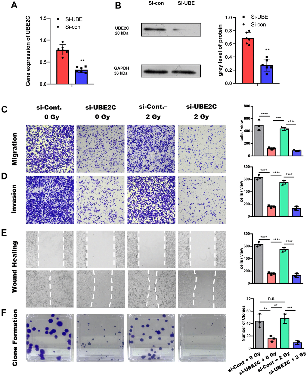 The knocking-down of UBE2C sensitized CAL27 cell to radiation in vitro. (A) RT-PCR results of UBE2C gene expression in CAL27 after Si-UBE/Con Lentivirus transfection. (B) Western blot results of UBE2C protein expression in CAL27 after Si-UBE/Con Lentivirus transfection. (C) Transwell (without matrigel) results of Si-UBE/Con CAL27 cells under 0/2 Gy radiation after 24h. (D) Transwell (with matrigel) results of Si-UBE/Con CAL27 cells under 0/2 Gy radiation after 24h. (E) Wound healing results of Si-UBE/Con CAL27 cells under 0/2 Gy radiation after 48h. (F) Clone formation results of Si-UBE/Con CAL27 cells under 0/2 Gy radiation after 14d. *P 