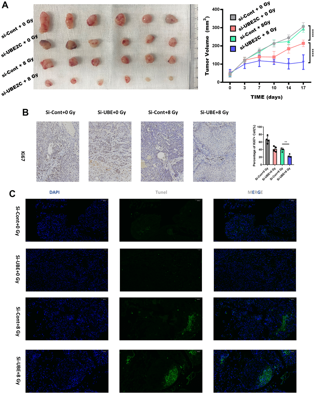 Silencing UBE2C sensitized CAL27 to radiation in vivo. (A) Representative images of subcutaneous tumors after treatment. The curves describe the average tumor volume in vivo of four different groups at different observing time. (B) Representative images of tumors from xenografts using immunohistochemical staining against Ki67. Magnification: ×200. (C) The percentage of TUNEL-positive cells was assessed in formalin-fixed paraffin embedding sections of tumors in each group. Magnification: ×200. *P 