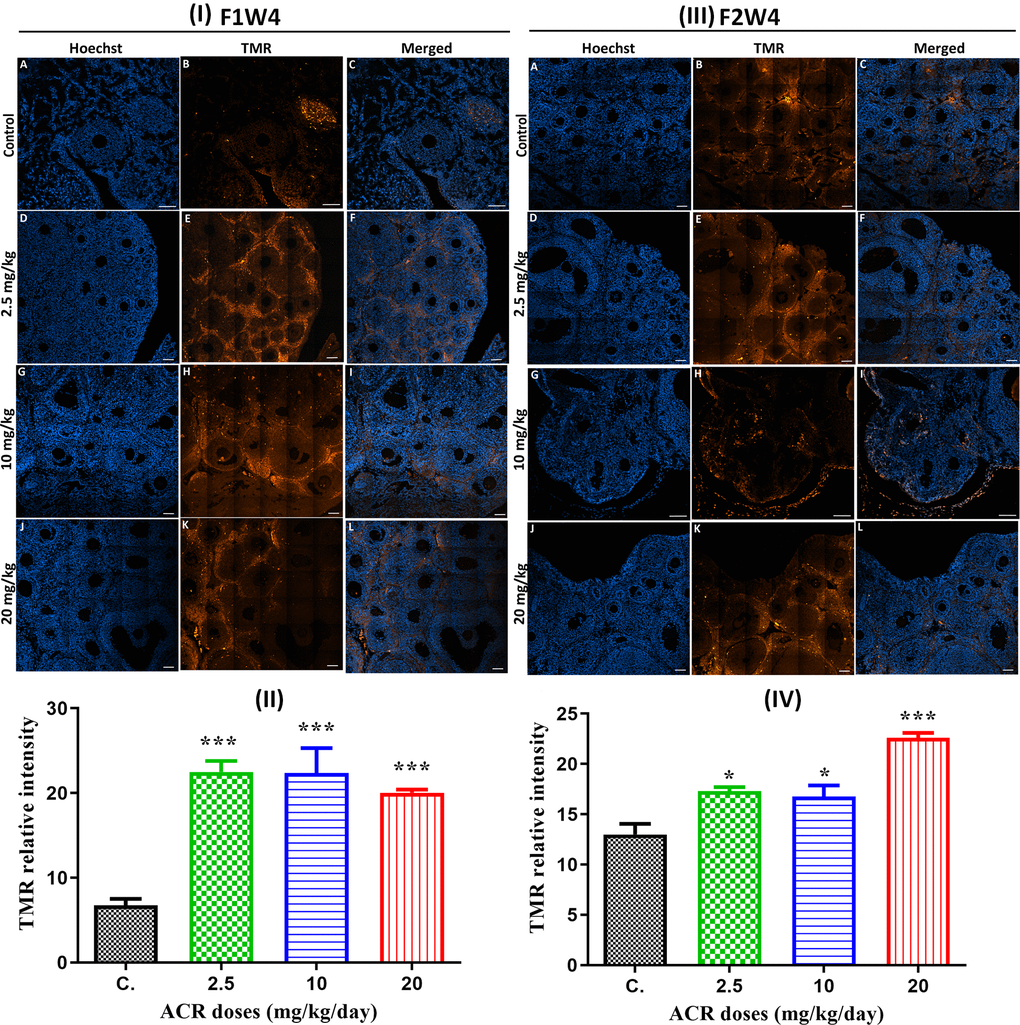 (I) TUNEL staining (red) of ovaries from AF1 females and normal CF2 females (A–C), and ovaries from AF1 with the dose of 2.5 mg/kg (D–F), 10 mg/kg (G–I), and 20 mg/kg (J–L). Both granulosa cells and oocyte nuclei were stained with Hoechst (blue). (II) TMR relative intensity in 4-week-old AF1 females compared with control CF1. (III) TUNEL staining (red) of ovaries from AF2 females and normal CF2 females (A–C), and ovaries from AF1 with the dose of 2.5 mg/kg (D–F), 10 mg/kg (G–I), and 20 mg/kg (J–L). Both granulosa cells and oocyte nuclei were stained with Hoechst (blue). (IV) TMR relative intensity in 4-week-old AF2 females compared with control CF2. Scale bar = 60μm.