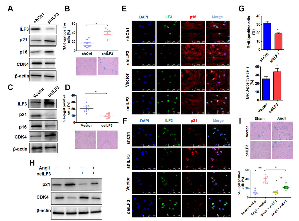 ILF3 overexpression suppresses Ang II-induced VSMC senescence. (A) Western blot detection of ILF3, p21, p16 and CDK4 expression in VSMCs transfected with shCtrl or shILF3. (B) SA-β-gal activity in VSMCs transfected with shCtrl or shILF3. The percentage of SA-β-gal positive cells (above) and representative pictures (below) are shown. Magnification × 400. *P C) Western blot detection of ILF3, p21, p16 and CDK4 expression in VSMCs transfected with empty vector or ILF3-expressing vector (oeILF3). (D) SA-β-gal activity in VSMCs transfected with empty vector or oeILF3. The percentage of SA-β-gal positive cells (above) and representative pictures (below) are shown. Magnification ×400. *P E) and (F) VSMCs were transfected with shILF3 or oeILF3 and their corresponding controls, and the expression of ILF3, p16 and p21 was examined by immunofluorescence staining. Green, red, and blue staining indicates ILF3, p16 (E), p21 (F) and the nuclei, respectively. Scale bar = 100 μm. (G) VSMCs were transfected as in (E), and cell proliferation was estimated by BrdU incorporation test. Graph presents means ± SD from at least three independent experiments. *P H) Western blot detection of p21 and CDK4 expression in VSMCs transfected with empty vector or oeILF3 followed by treatment with or without Ang II. (I) SA-β-gal activity in VSMCs transfected with empty vector or oeILF3 followed by treatment with or without Ang II. The percentage of SA-β-gal positive cells (bottom) and representative pictures (top) are shown. Magnification × 400. *P P 